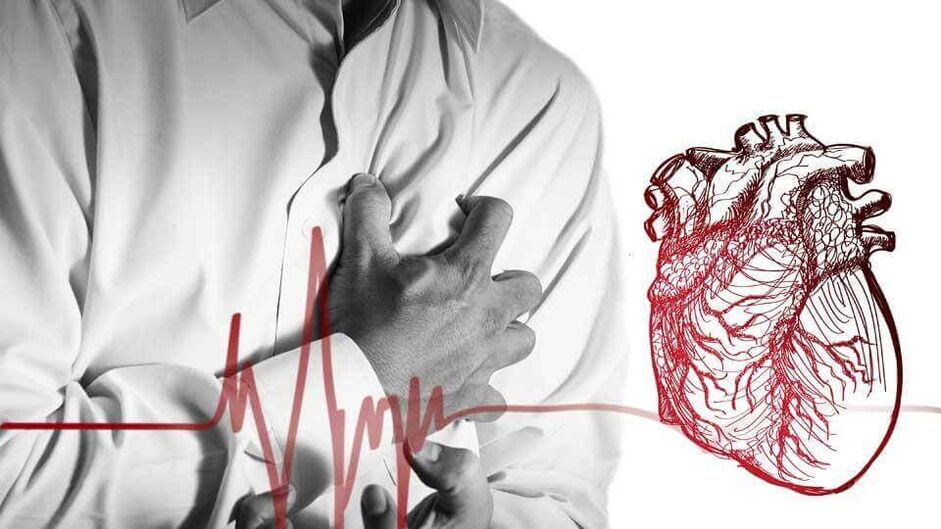 A extrasístole pode ocorrer debido á arritmia cardíaca na osteocondrose torácica