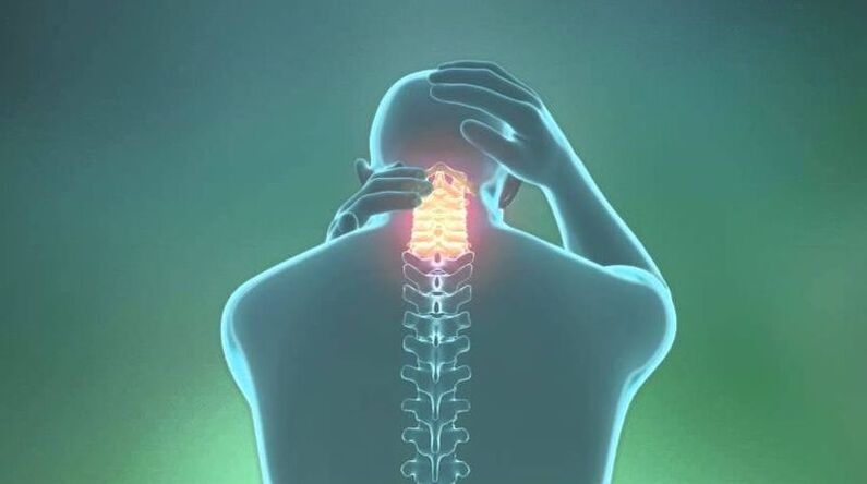 Osteocondrose da rexión do cérvix