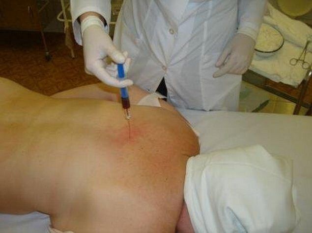 Preparativos para a osteocondrose