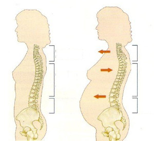 Osteocondrose durante o embarazo